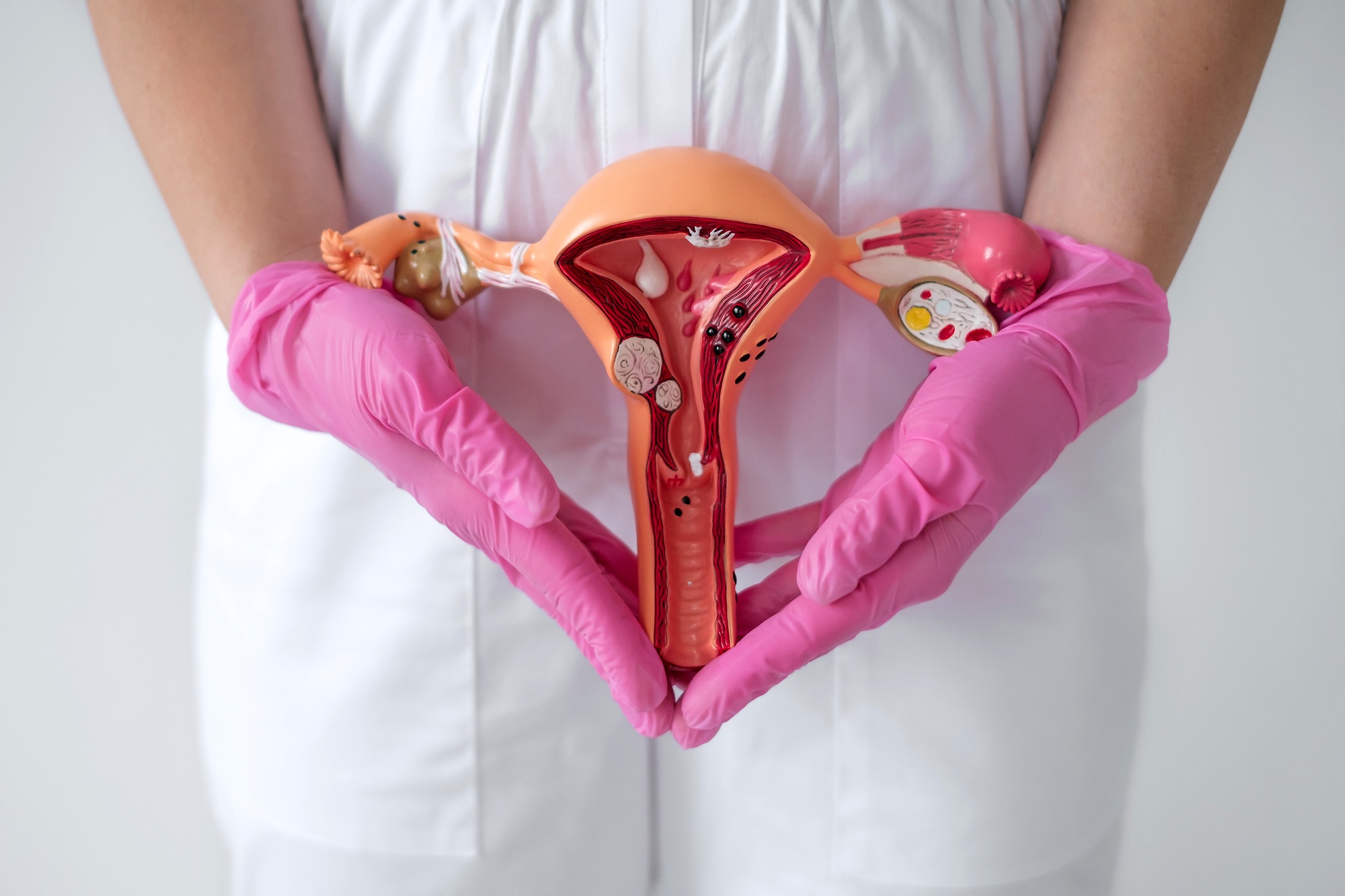 A model of female reproductive organs.